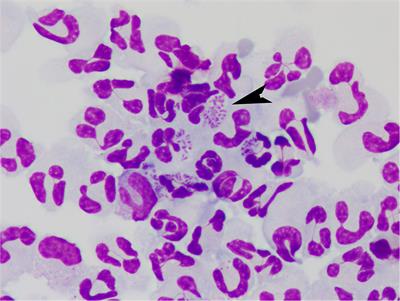 Case Report: Bordetella bronchiseptica Meningoencephalomyelitis in a Dog